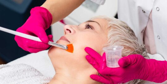 Chemical Peels treatments metro Atlanta Alpharetta Georgia Medspa