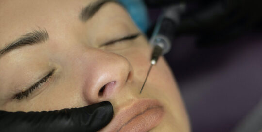 MedSpa Skin Treatments in metro Atlanta and Alpharetta in north Georgia - Injection fillers