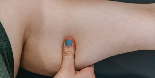 MedSpa Skin Treatments in metro Atlanta and Alpharetta in north Georgia - Weight Loss treatments and injections